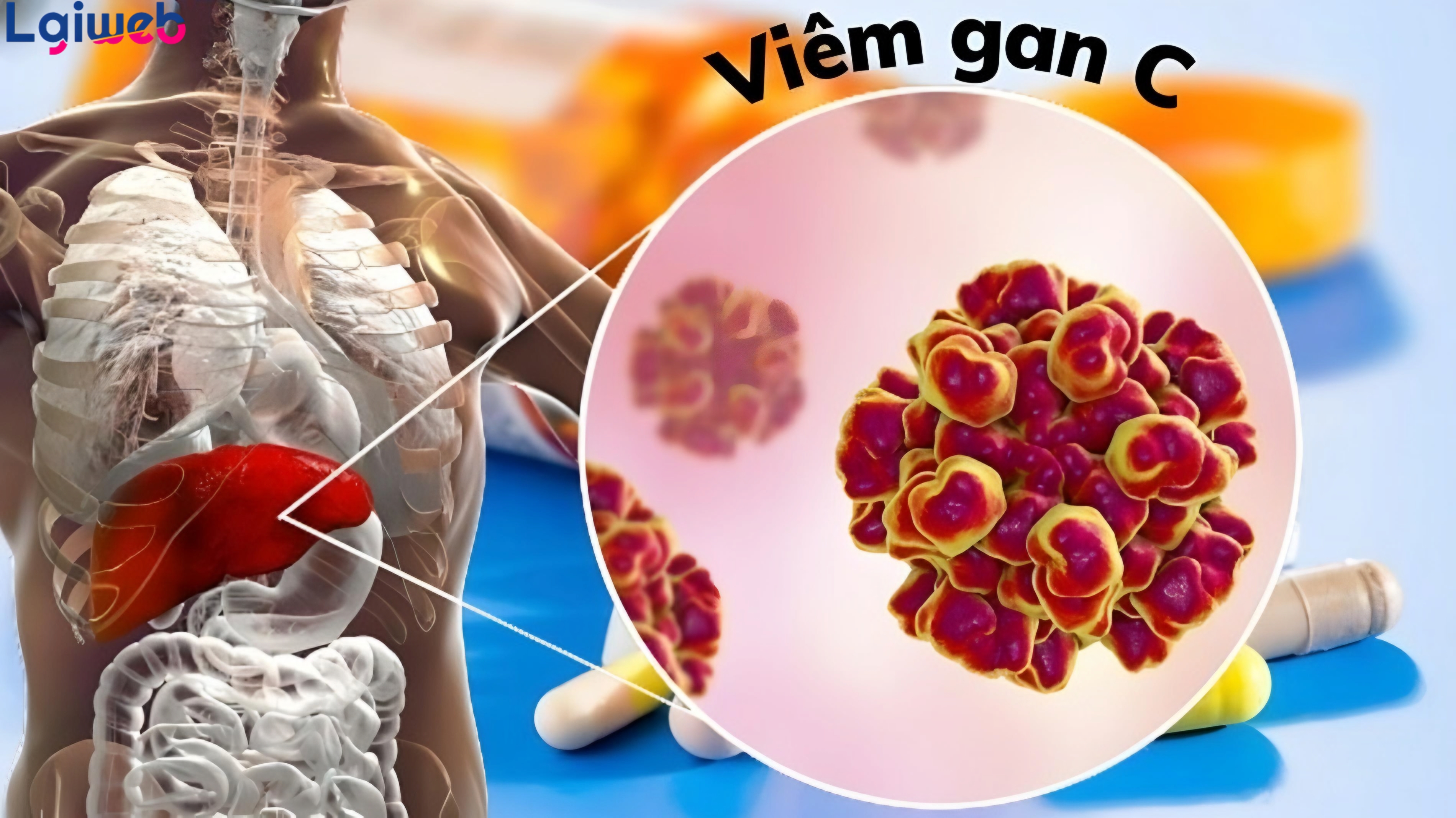 Viêm gan C là gì? Viêm gan C là gì?