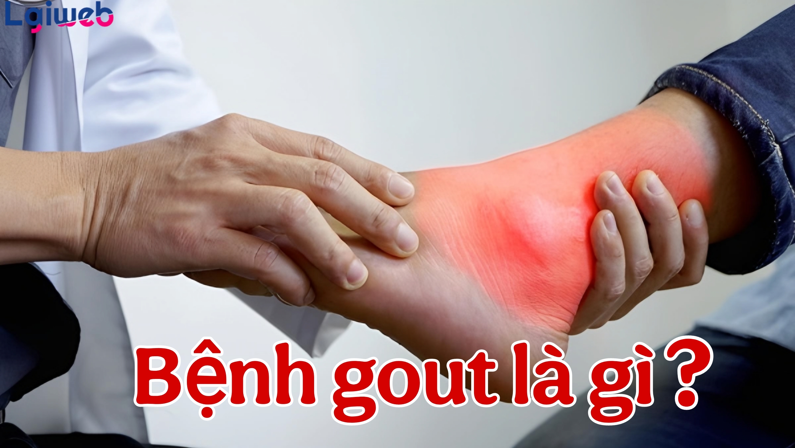 Bệnh Gout là gì? Bệnh Gout là gì?