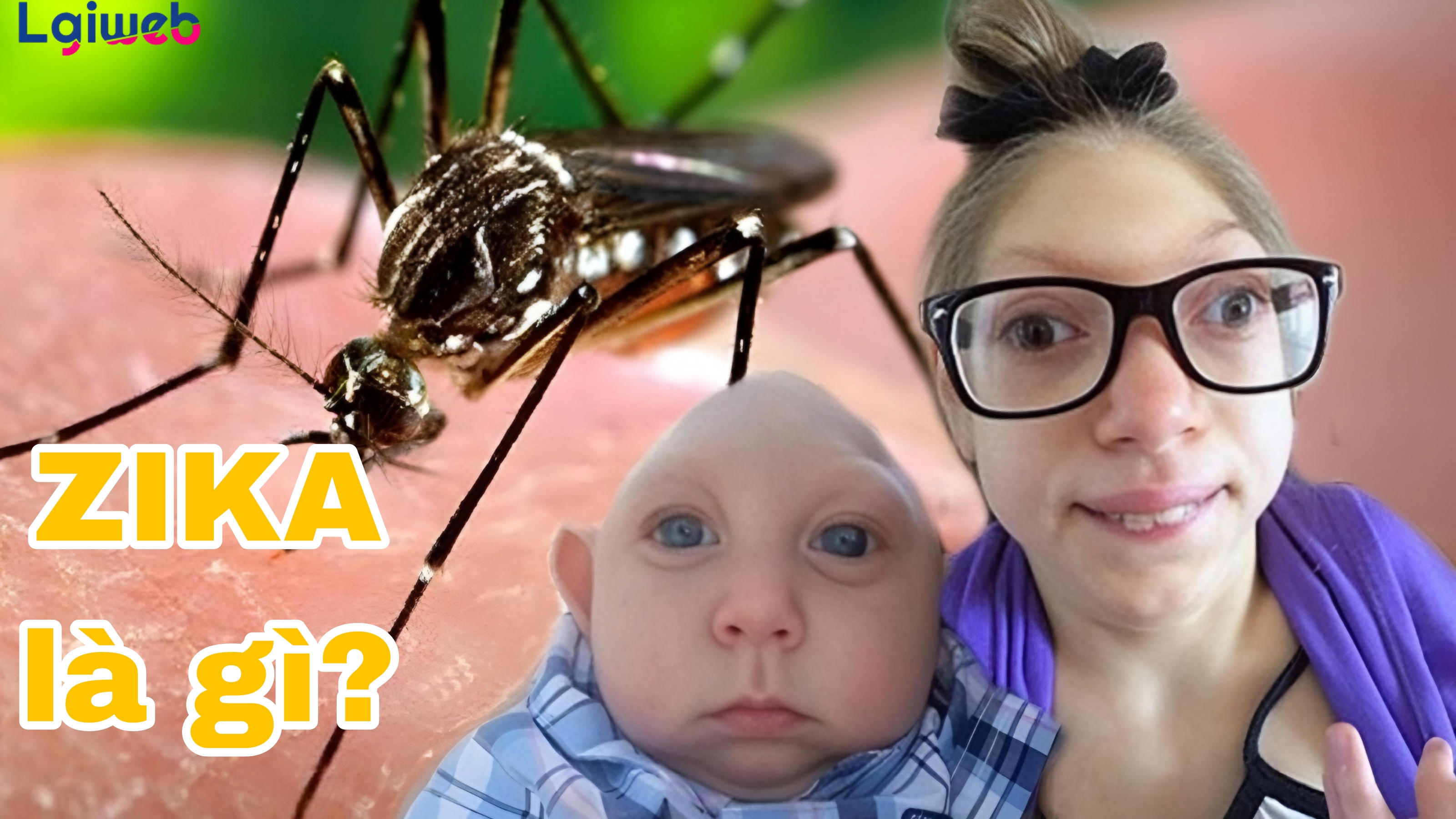 Zika là gì? Zika là gì?