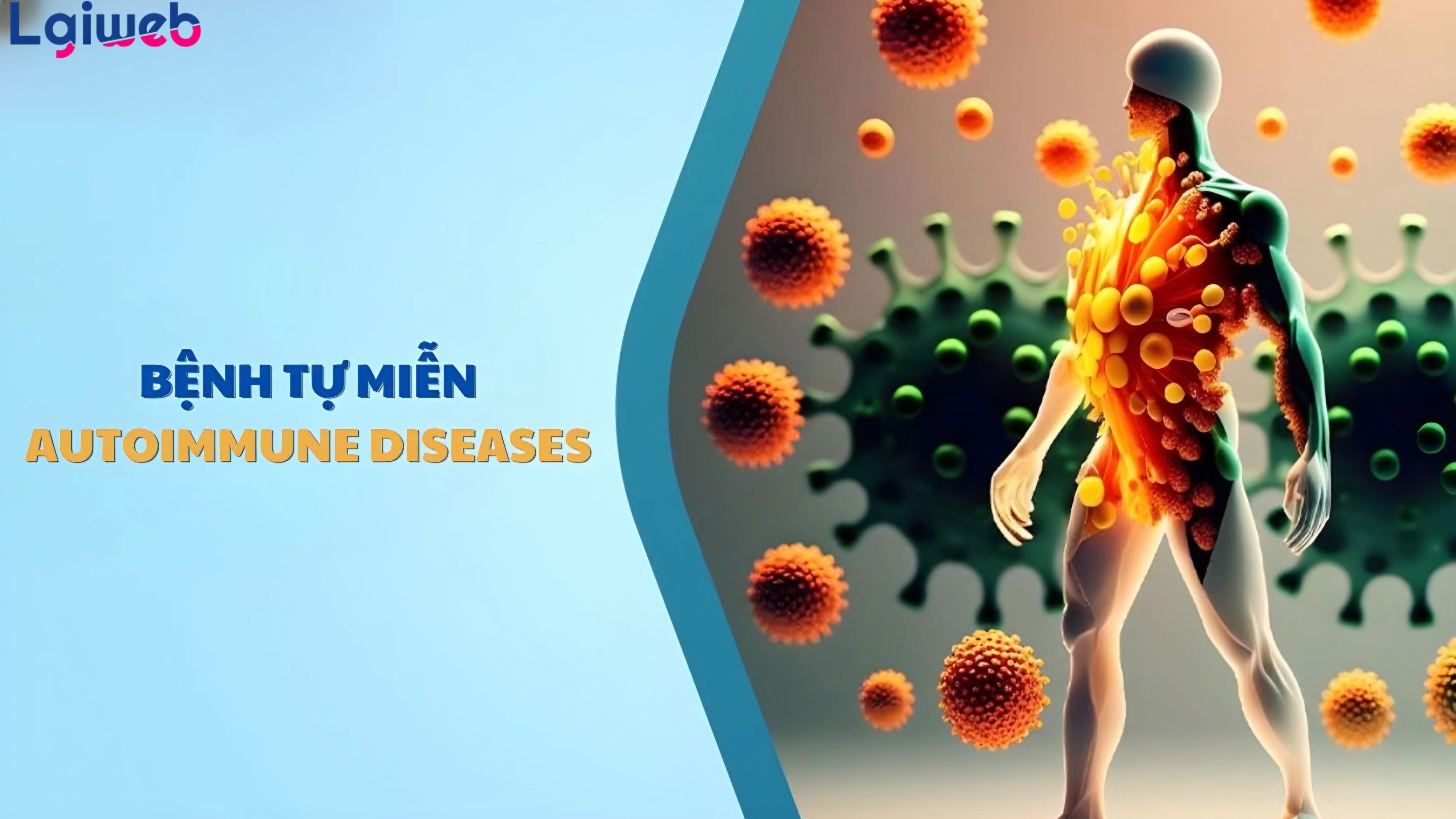Bệnh tự miễn là gì? Bệnh tự miễn là gì?