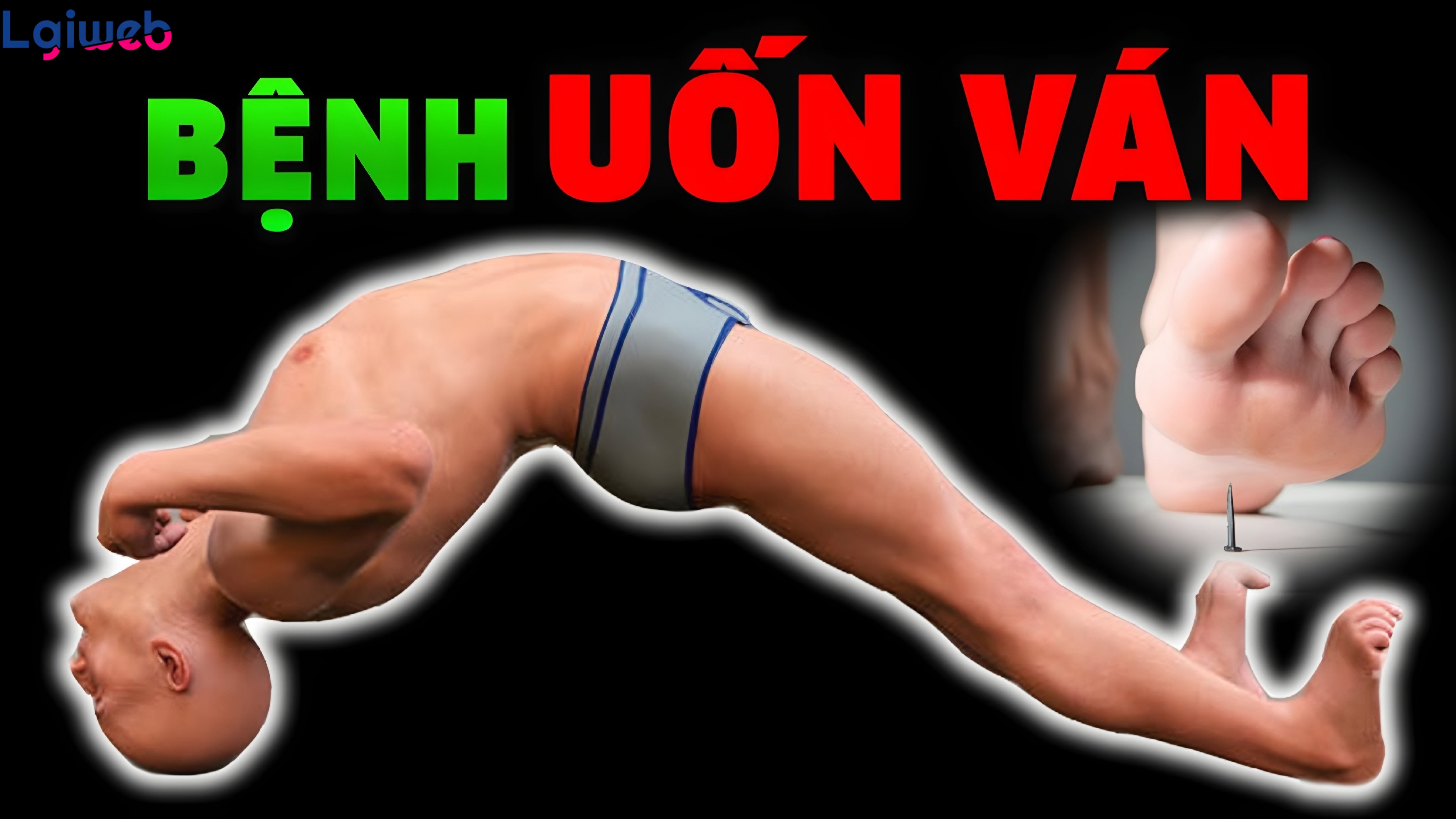 Bệnh Uốn Ván Là Gì? Bệnh Uốn Ván Là Gì?