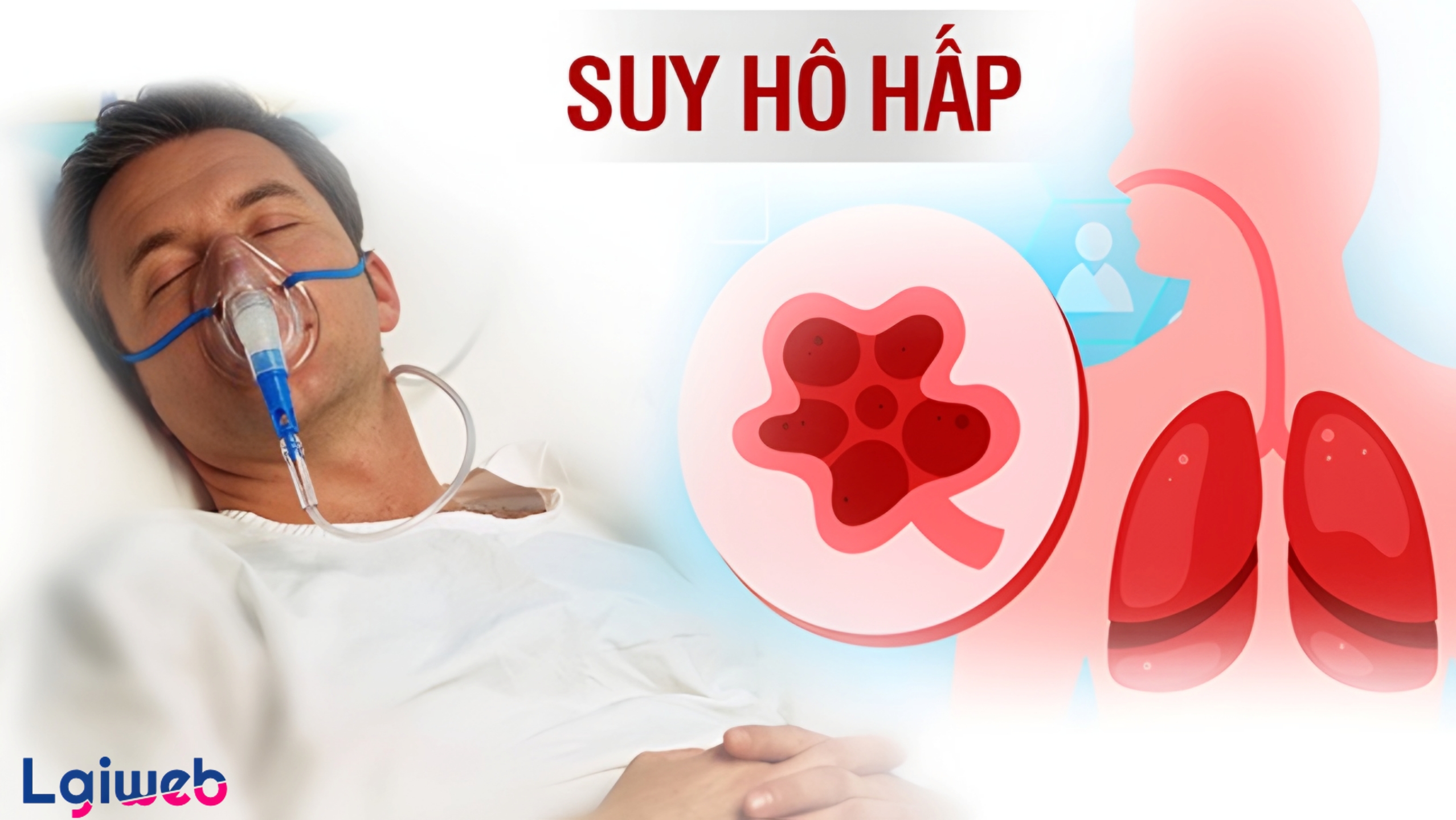Suy hô hấp là gì? Suy hô hấp là gì?