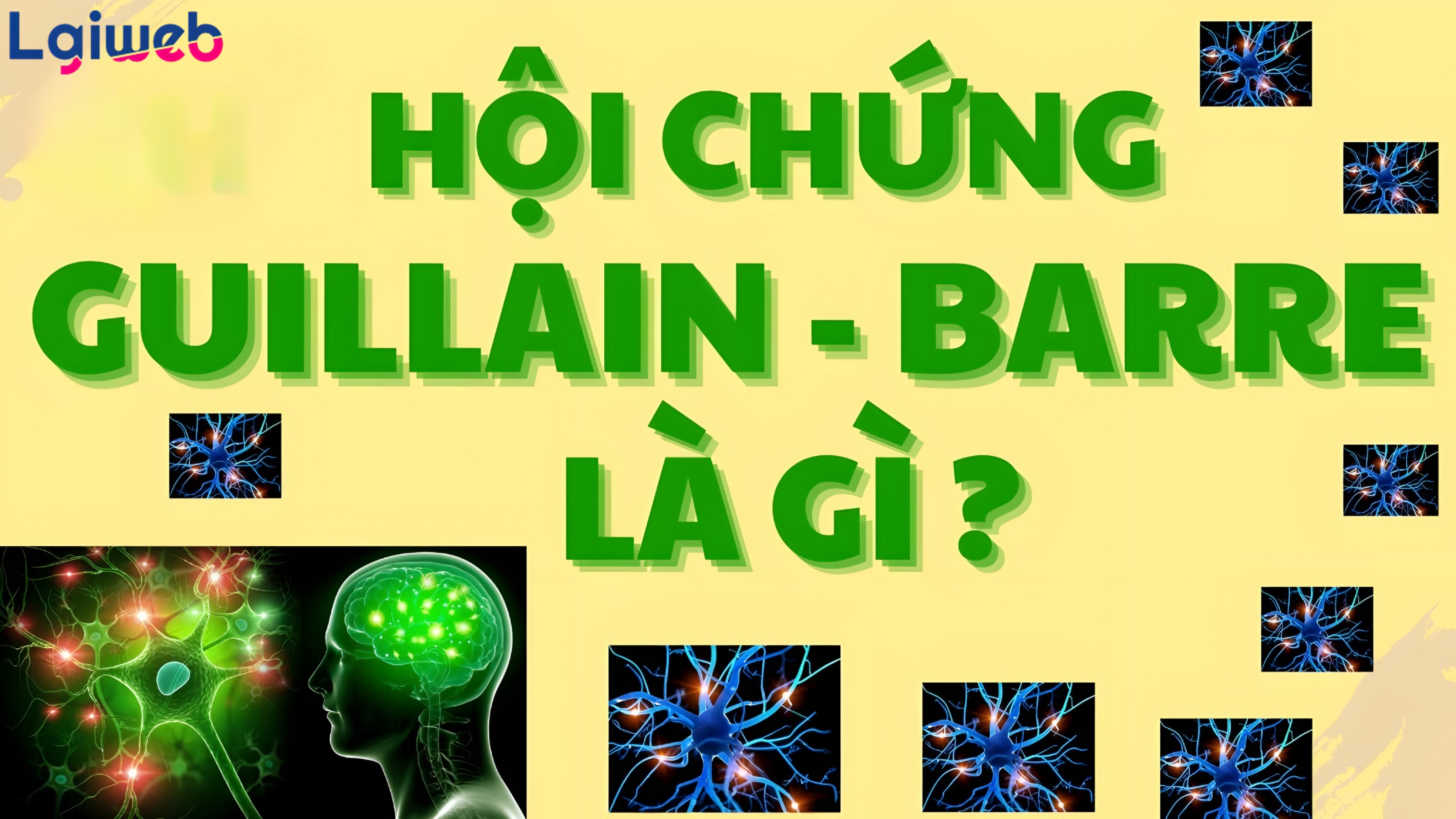 Hội chứng Guillain-Barré là gì? Hội chứng Guillain-Barré là gì?