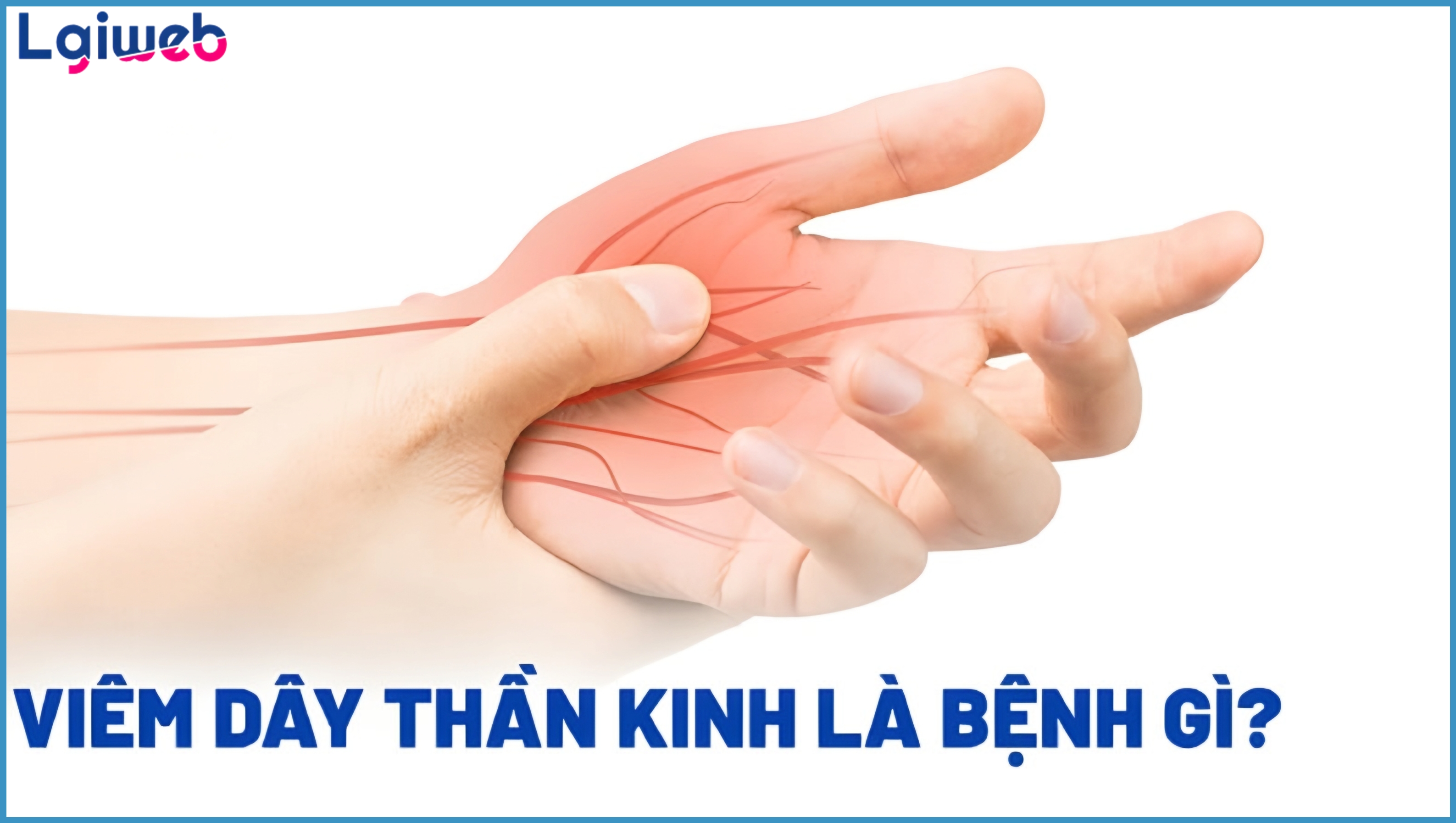 Viêm Dây Thần Kinh Là Gì? Viêm Dây Thần Kinh Là Gì?