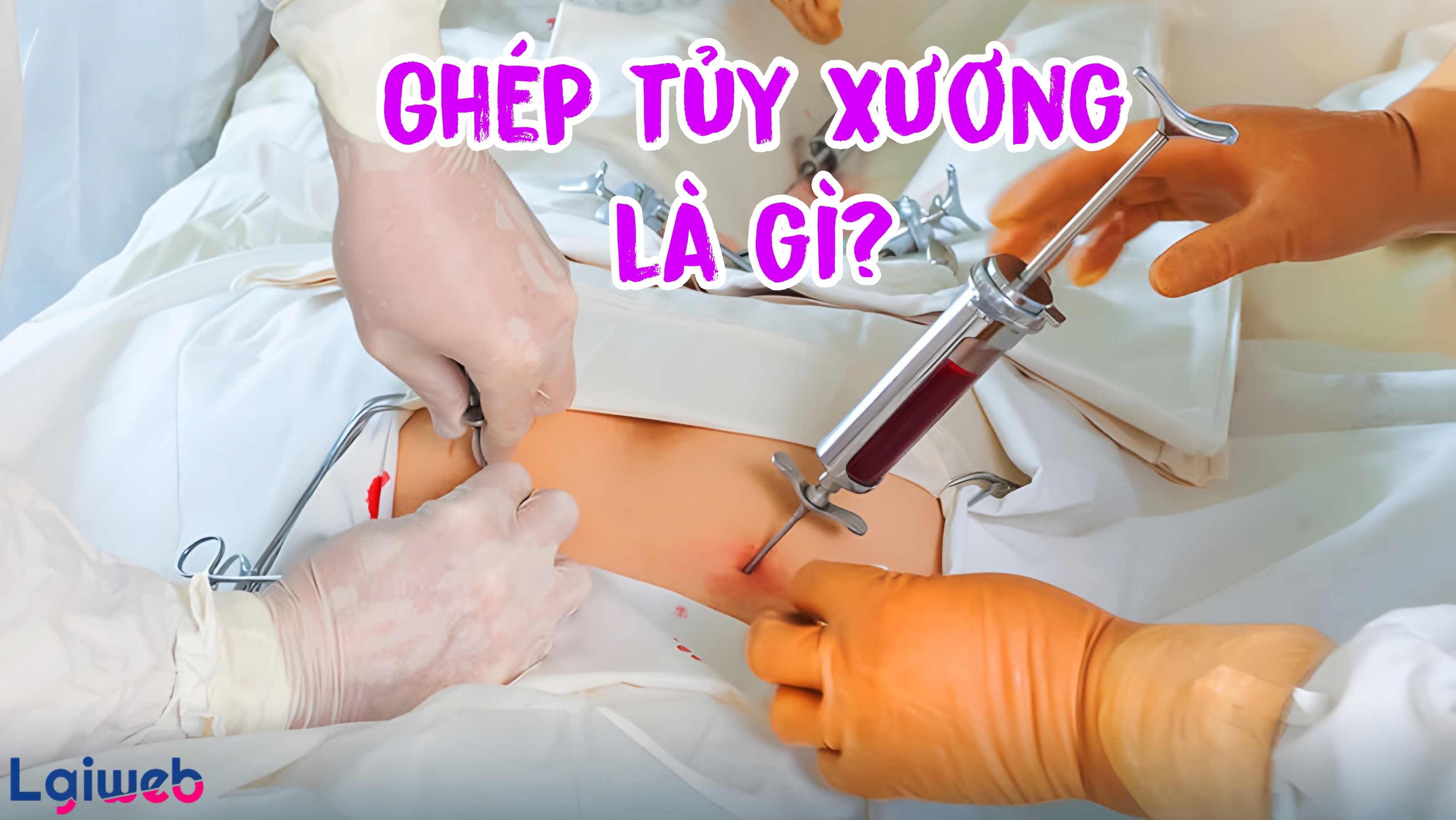Ghép tủy xương là gì? Ghép tủy xương là gì?